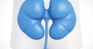 Urological Surgery for Kidney Stones